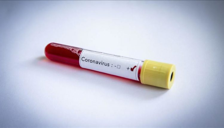 corona_virus_Kdb40aALJp