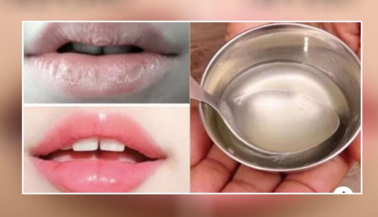 lips1617343424_1200